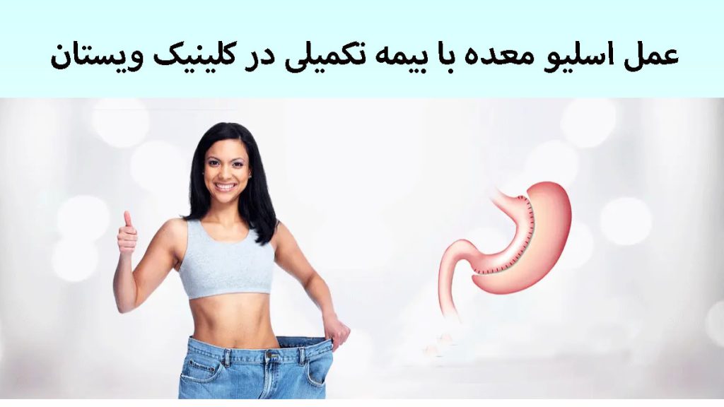 یک خانم که با عمل اسلیو معده لاغر شده است