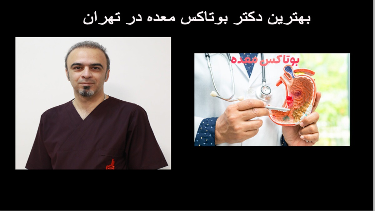 دکتر متخصص بوتاکس معده در تهران