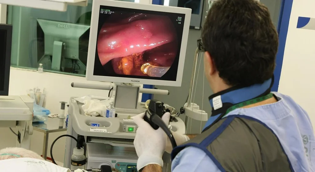 هزینه آندوسکوپی با بیهوشی + بیمه هزینه آندوسکوپی پوشش میدهد؟