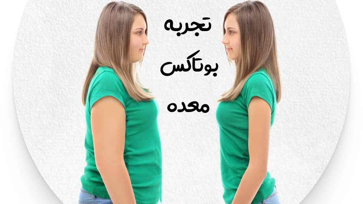 نظرات مردم در مورد بوتاکس معده