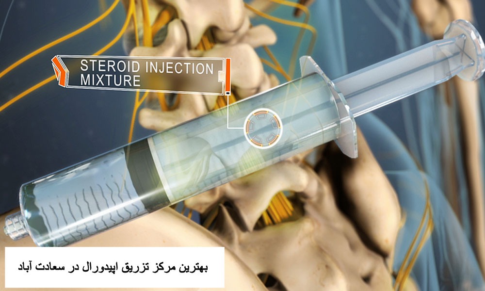 بهترین مرکز تزریق اپیدورال کمر در سعادت آباد