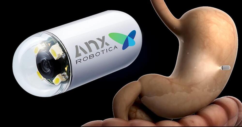 آندوسکوپی با بیهوشی و بدون بیهوشی