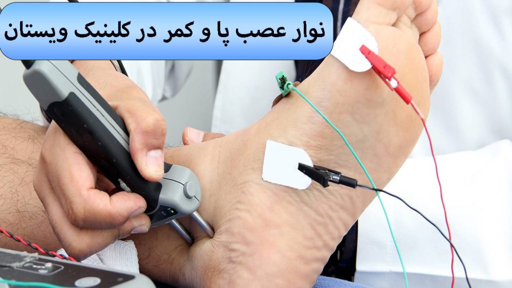 پای یک شخص و یک پزشک در حال گرفتن نوار عصب پا