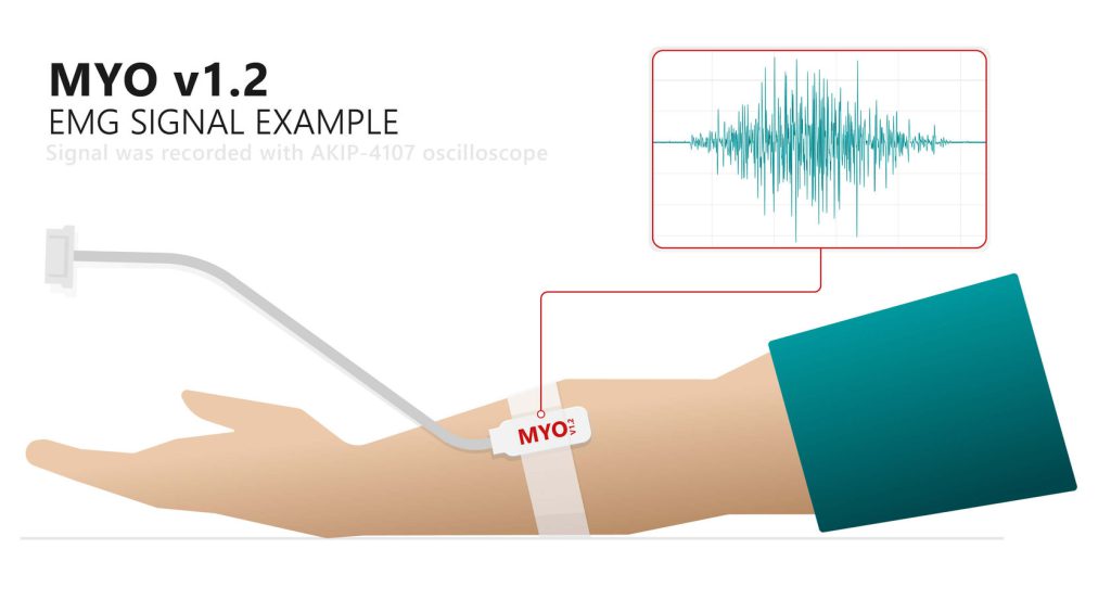 تست نوار عصب دست کاربردها و مزایا، عوارض + نظرات بیماران EMG