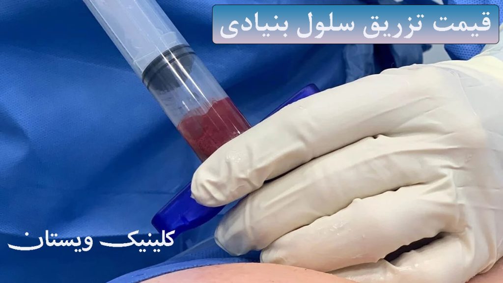 دست یک پزشک و سررنگ حاوی سلول بنیادی + نوشته با عنوان قیمت تزریق سلول بنیادی