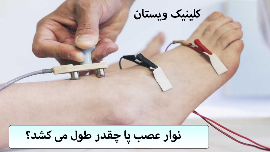 الکترودهای نوار عصب بر روی پای یک شخص