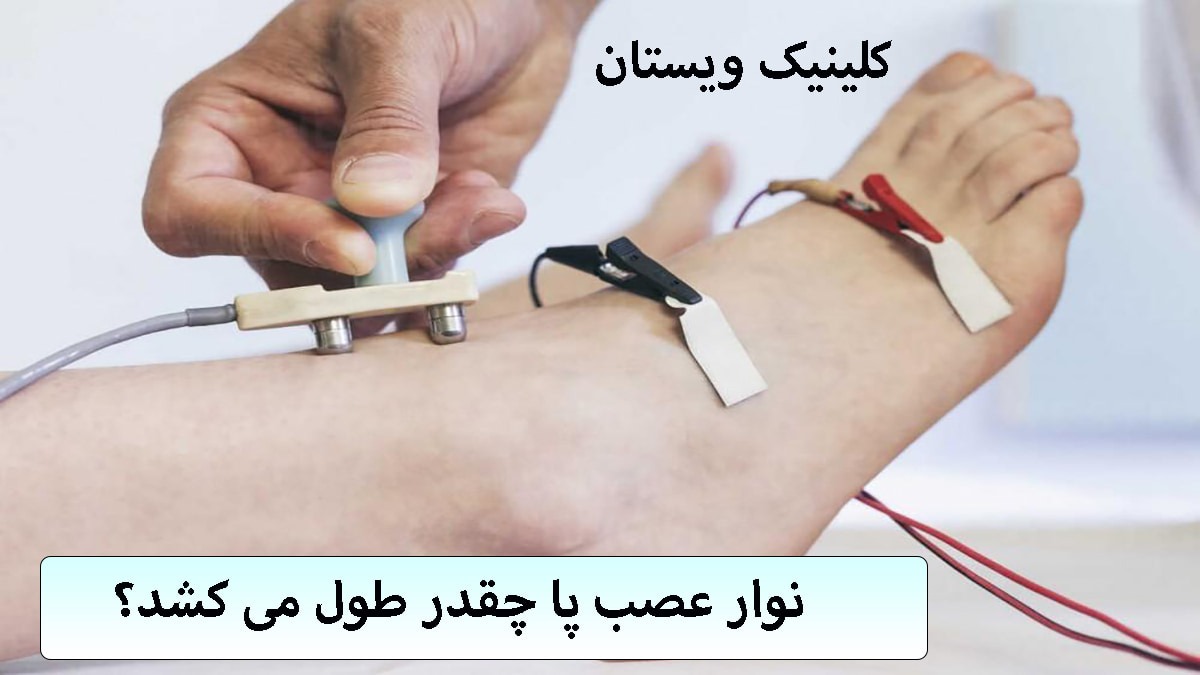 مدت زمان نوار عصب پا الکترودهای نوار عصب و عضله بر روی پای یک شخص