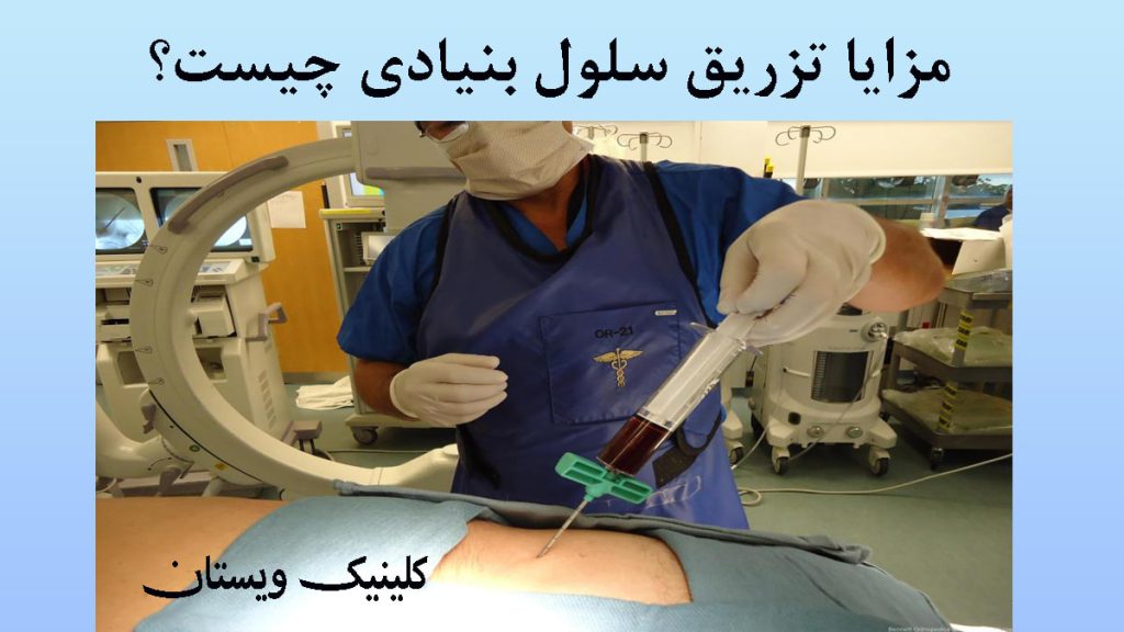 یک پزشک در حال تزریق سلول بنیادی