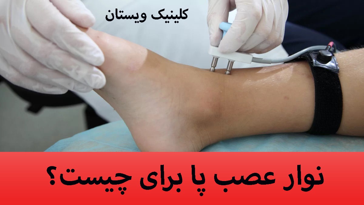 نوار عصب پا نوار عصب و عضله پا برای چیست؟+ یک پزشک در حال گرفتن نوار عصب پا
