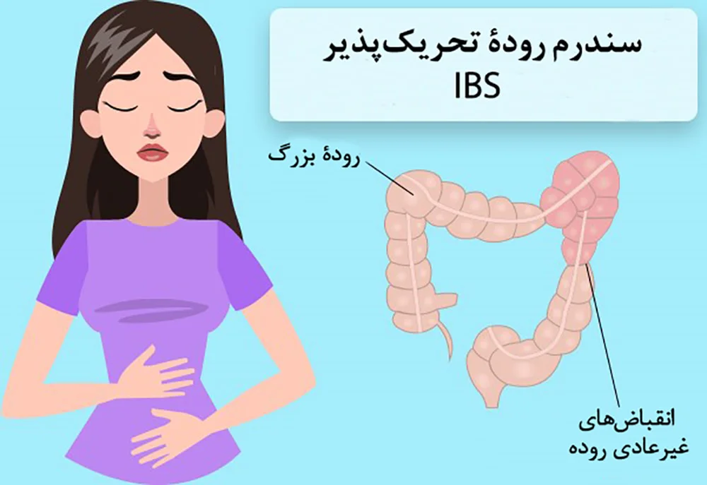 سندروم تحریک روده سندروم روده تحریک پذیر