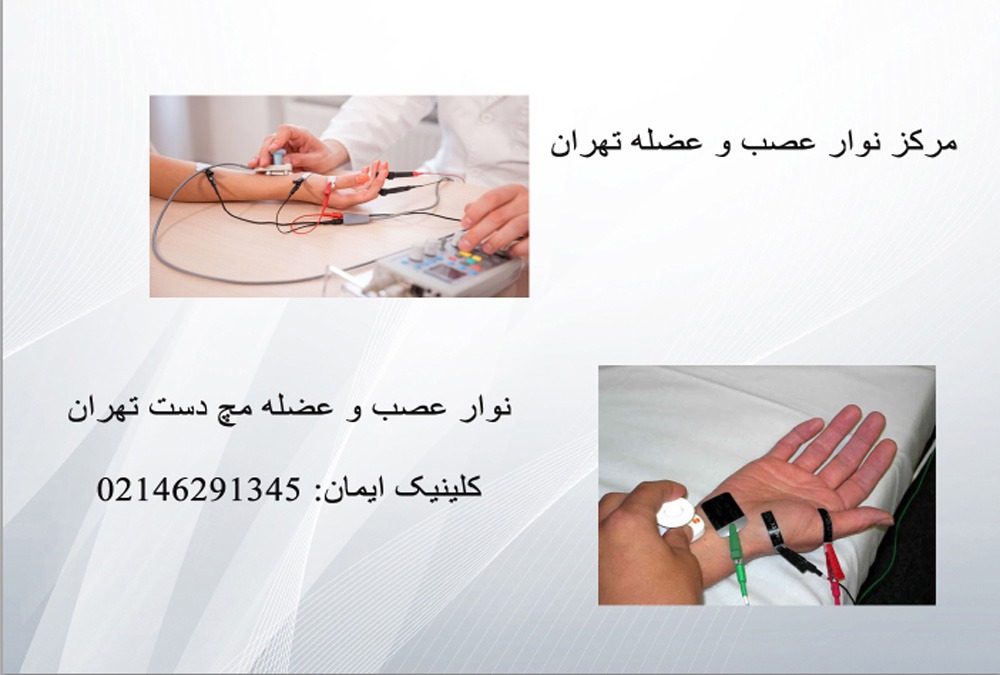 مرکز تست نوار عصب عضله تهران