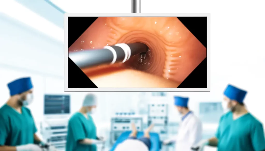 بهترین مرکز آندوسکوپی معده در غرب تهران