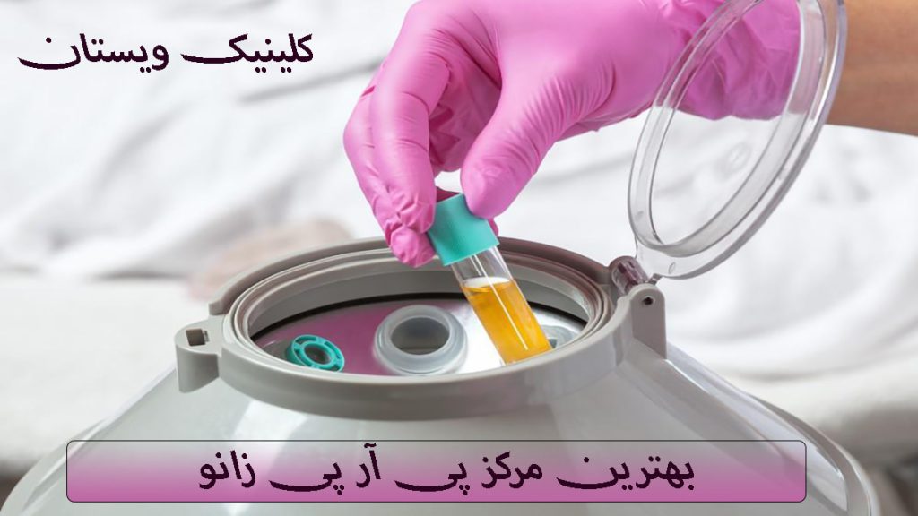 بهترین مرکز پی آر پی زانو یک دستگاه استخراج پی آر پی و یک ظرف پیار پی در دست پزشک
