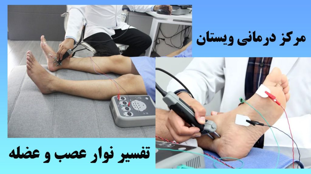 فرایند تست emg دو تصویر از نوار عصب و عضله پا