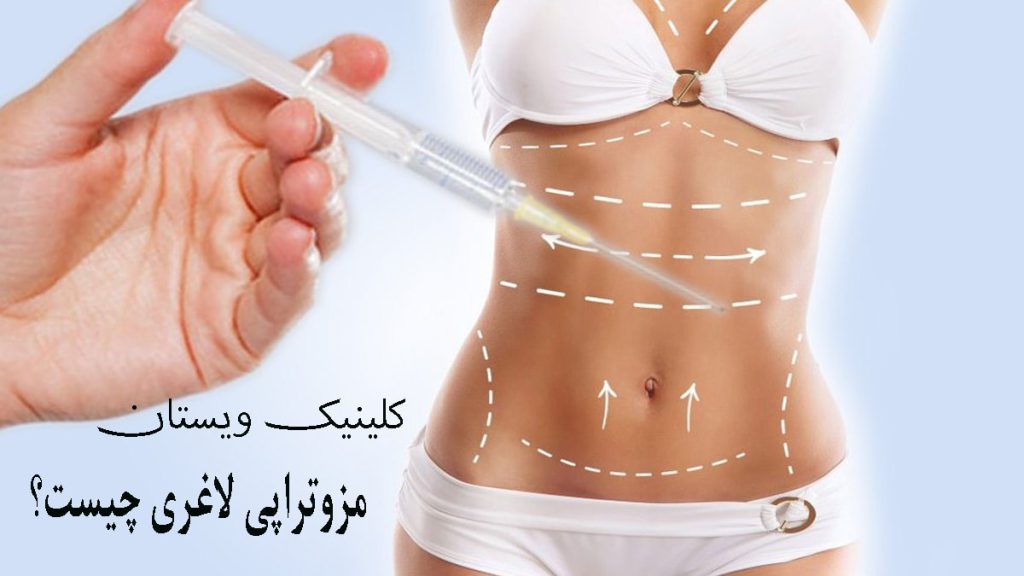 یک آمپول لاغری در دست شخص در کنار یک خانم با خط کشی لاغری شکم