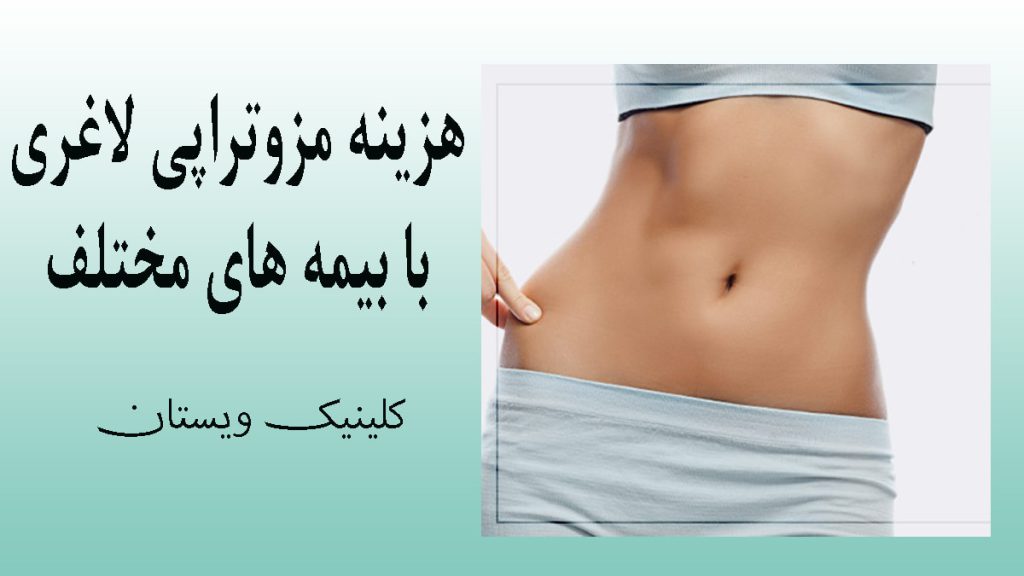 یک خانم بعد از مزوتراپی لاغری
