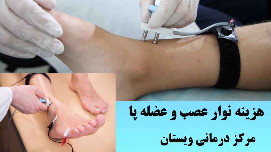دو تصویر روی هم از نوار عصب و عضله پا