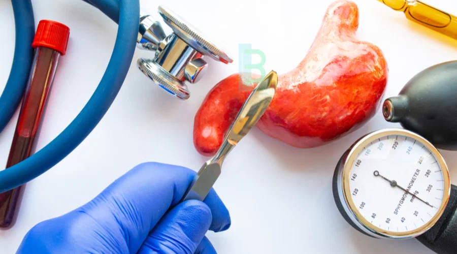 عمل اسلیو معده چگونه است؟