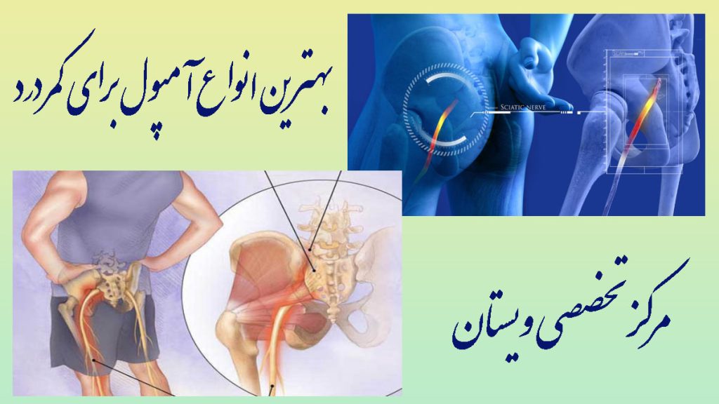 انواع آمپول برای کمردرد دو تصویر از درد کمر و سیاتیک