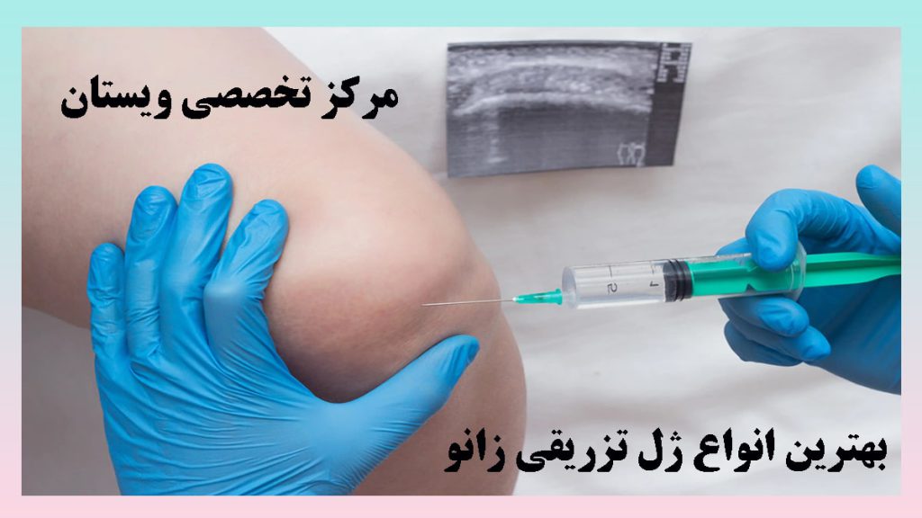 انواع ژل تزریقی زانو یک پزشک -دستکش آبی - تزریق آمپول به زانو