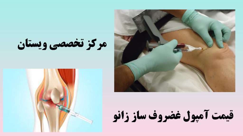 قیمت آمپول غضروف ساز دو تصویر از تزریق آمپول به زانو -نوشته : قیمت آمپول غضروف ساز زانو 1404