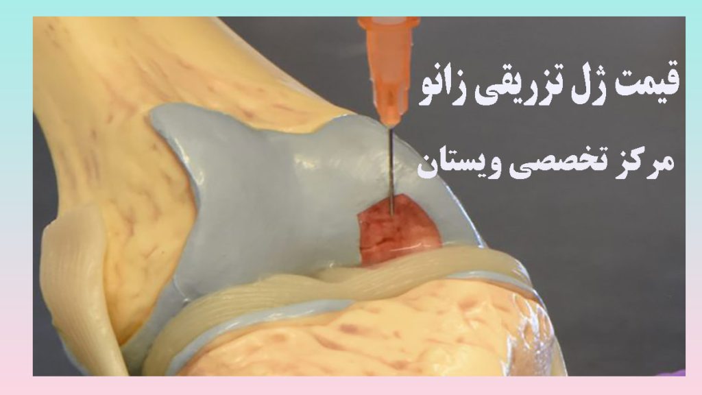 قیمت ژل تزریقی زانو تصویر انیمیشنی از تزریق به داخل مفصل زانو