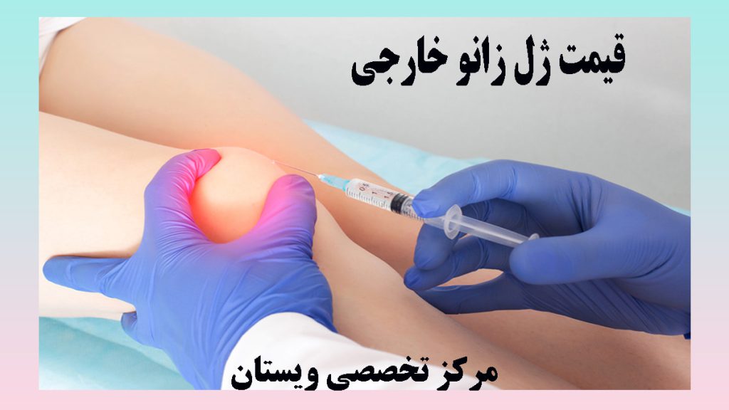 ژل زانو خارجی زانوی بیمار با رنگ زرد و قرمز نشان داده شده و پزشک در حال تزریق آمپول به آن است