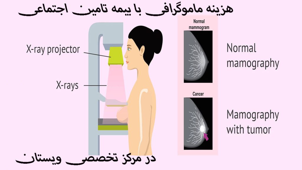 تصویری انیمیشنی از یک خانم در کنار دستگاه ماموگرافی