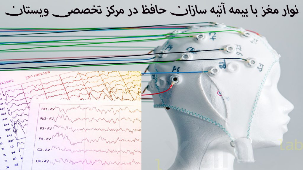 یک مولاژ مغز که به آن الکترودهای نوار مغز وصل شده است