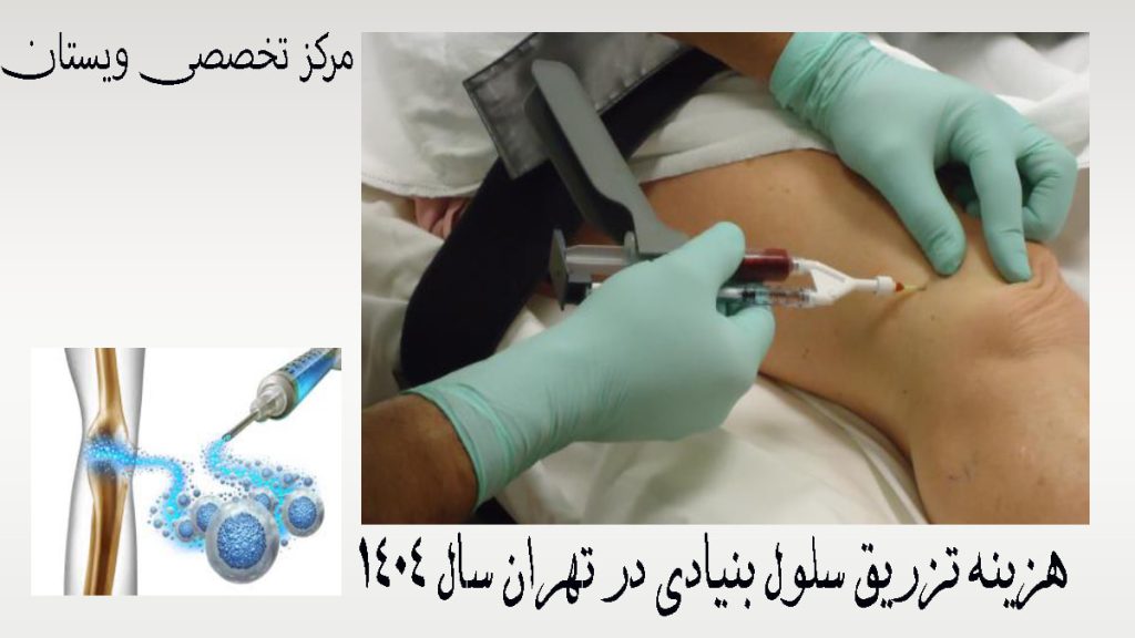 یک پزشک در حال تزریق سلول بنیادی به زانو