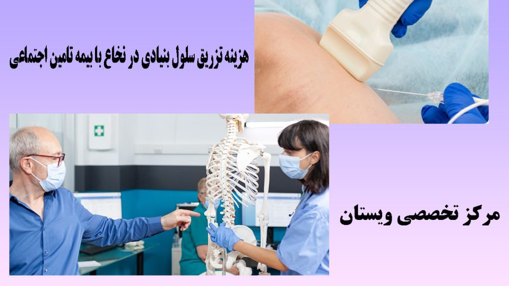تزریق سلول بنیادی در نخاع دو تصویر از دو پزشک در حال نشان دادن نخاع برای تزریق سلول بنیادی