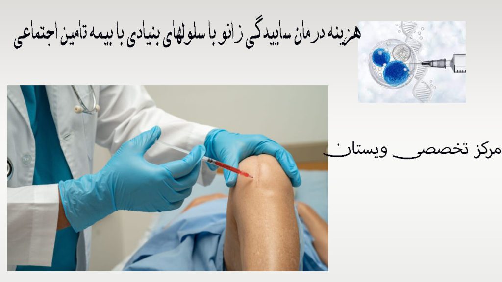 دو تصویر از تزریق سلول بنیادی به زانو