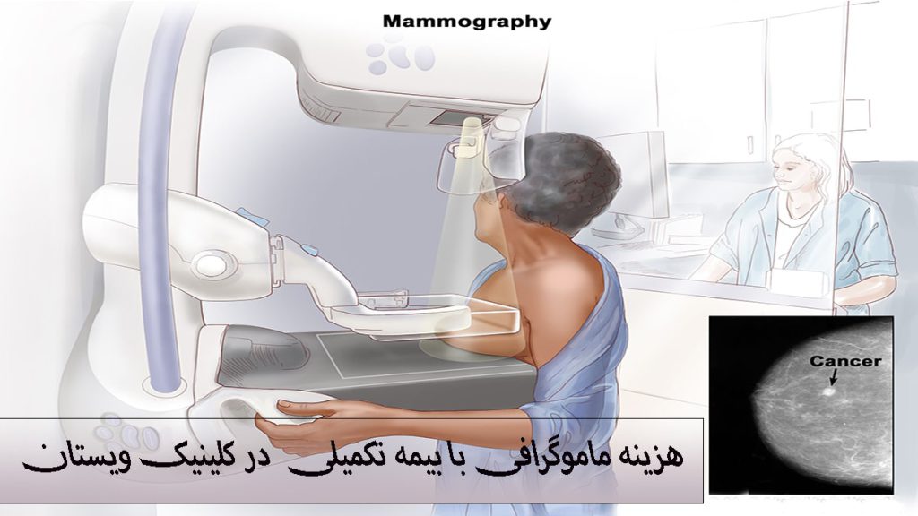 تصویری انیمیشنی از یک خانم در دستگاه ماموگرافی