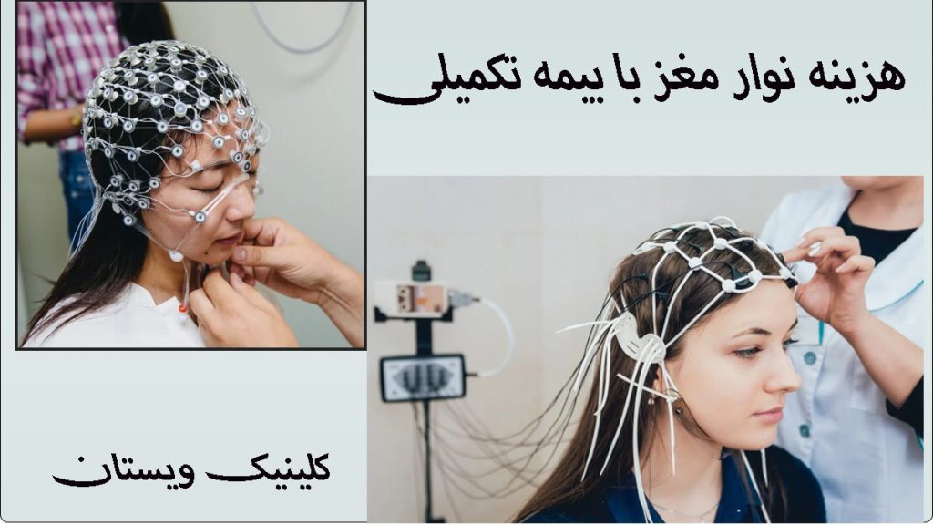 دو بیمار در حال گرفتن نوار مغز