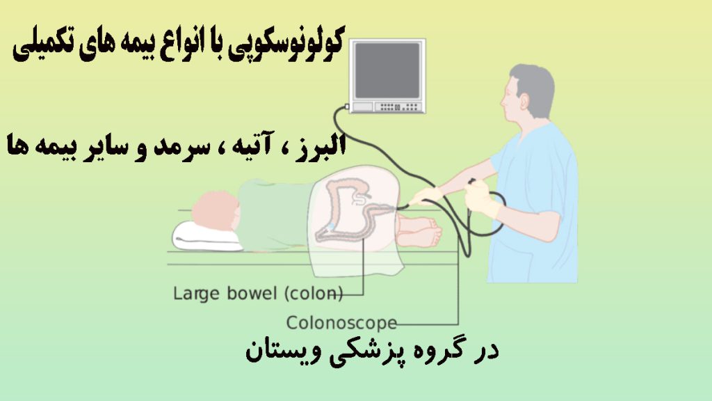 پزشک در حال گرفتن تست کولونوسکوپی- تصویر انیمیشنی است