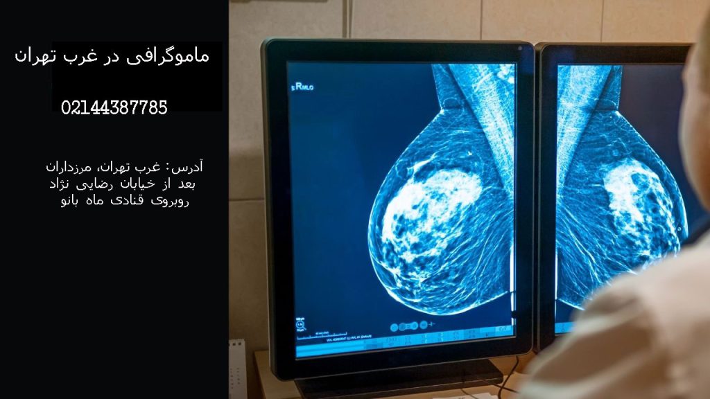 لیست بهترین مراکز ماموگرافی در غرب تهران + سعادت آباد،صادقیه