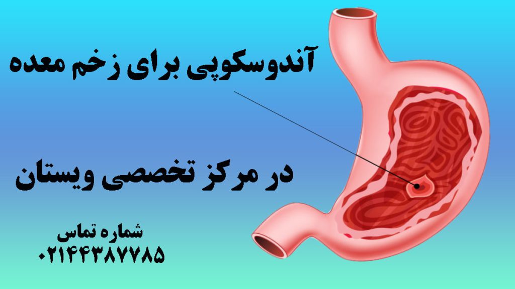 تصویر انیمیشنی از معده و زخم معده