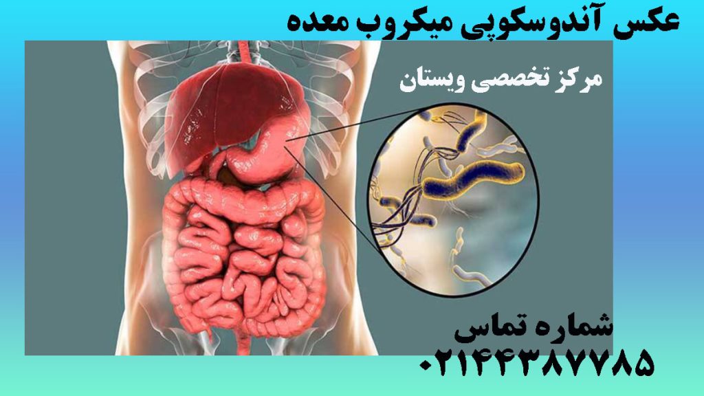 میکر.ب معده بصورت زوم شده در کنار یک تصویر از معده انسان