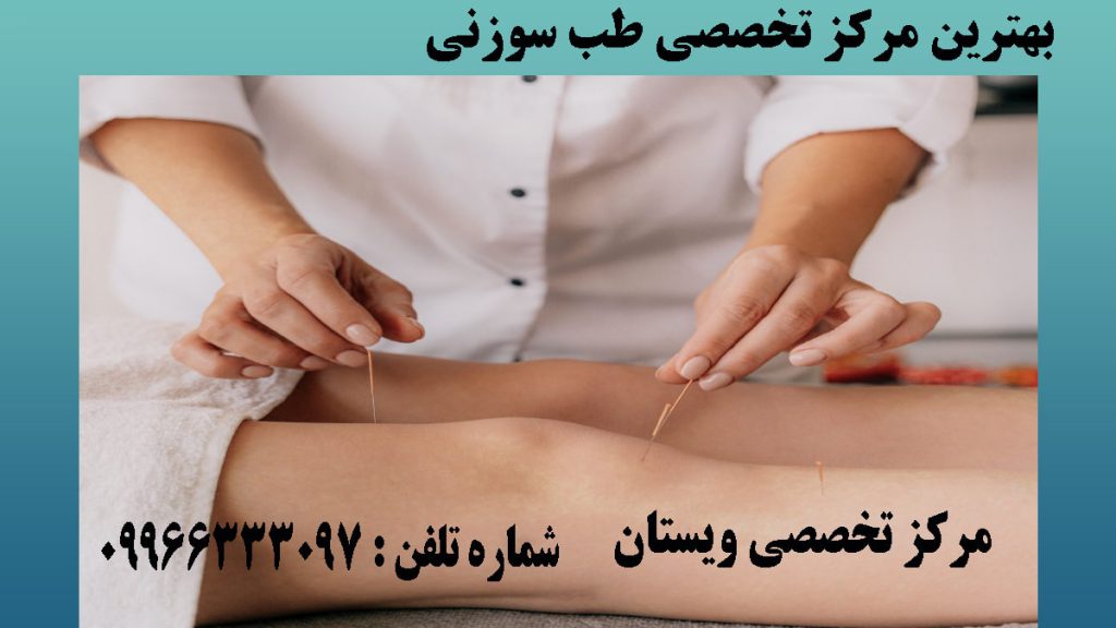 یک پزشک خانم در حال انجام طب سوزنی روی زانو بیمار