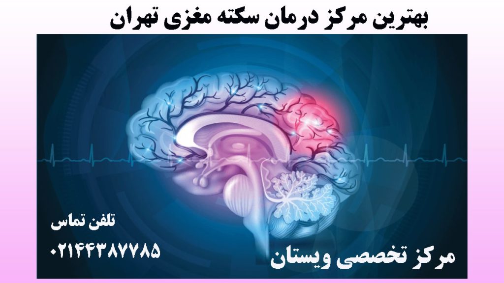 تصویر دیجیتالی از مغز