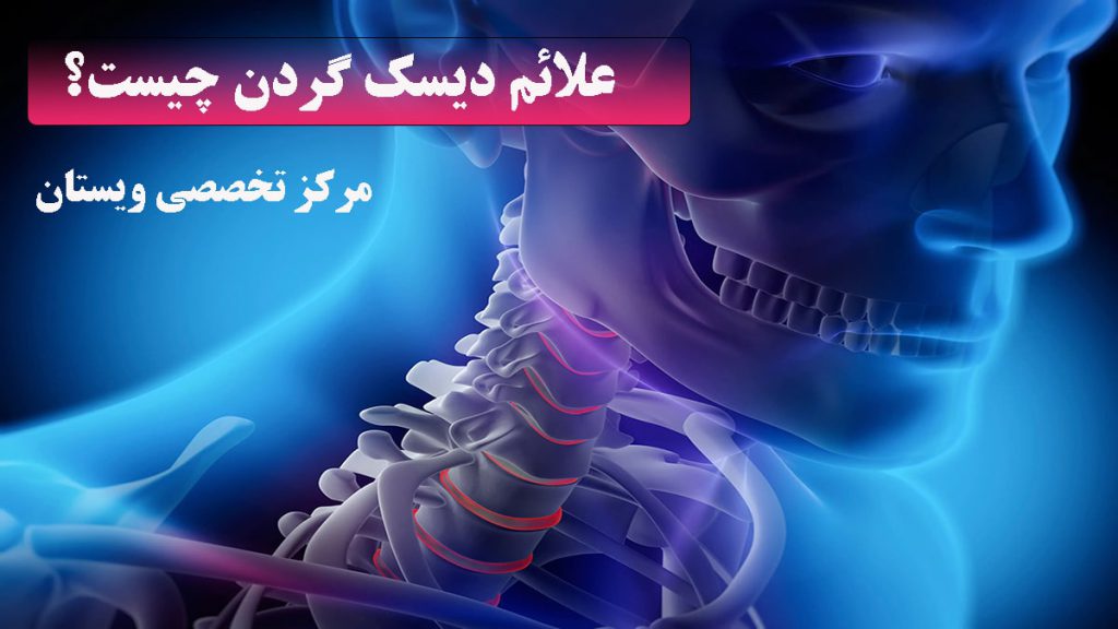 تصویر دیجیتالی از صورت و رگدن انسان-نوشته : علائم دیسک گردن