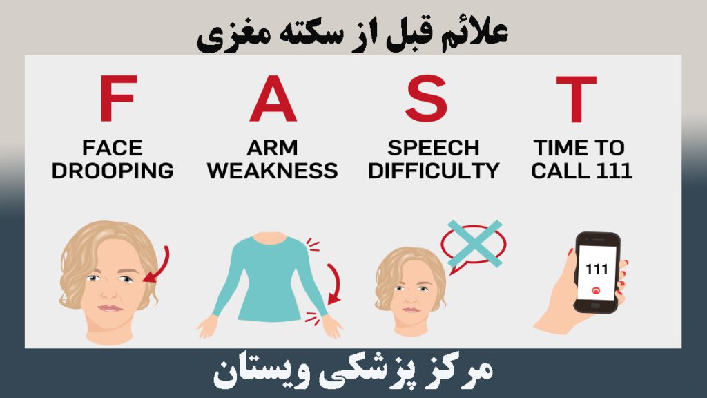 علائم سکته مغزی در چند تصویر آماده است