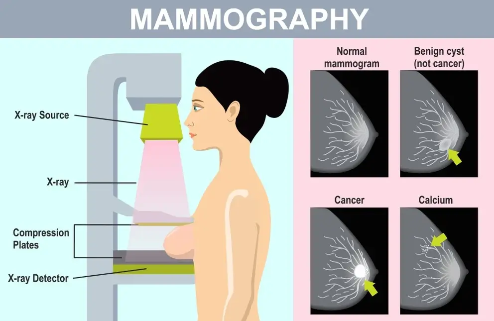 بهترین مرکز ماموگرافی در غرب تهران
