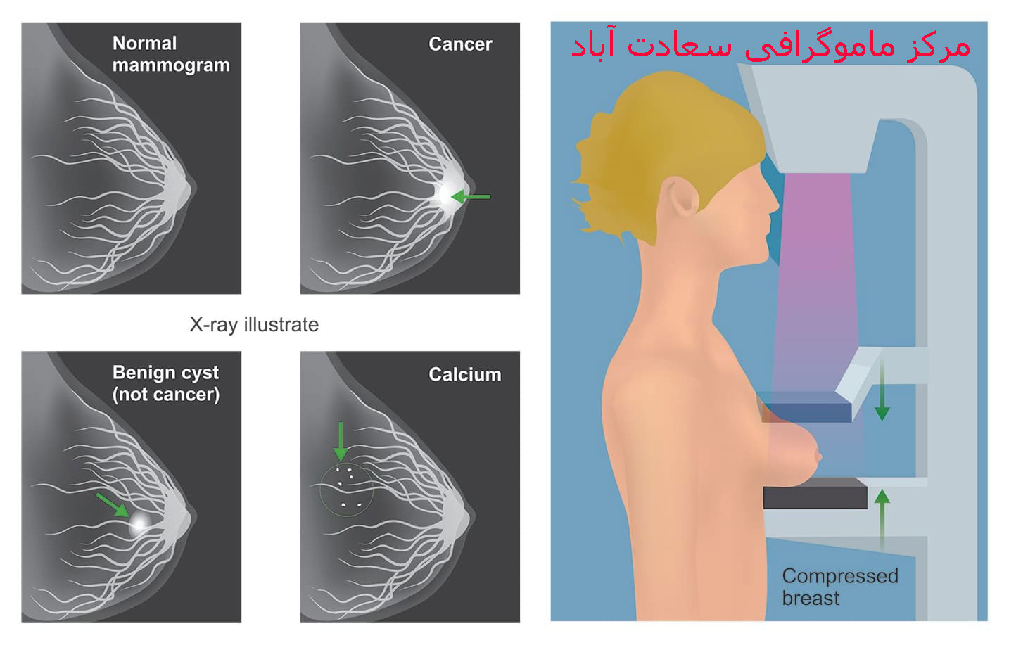مرکز ماموگرافی در سعادت آباد