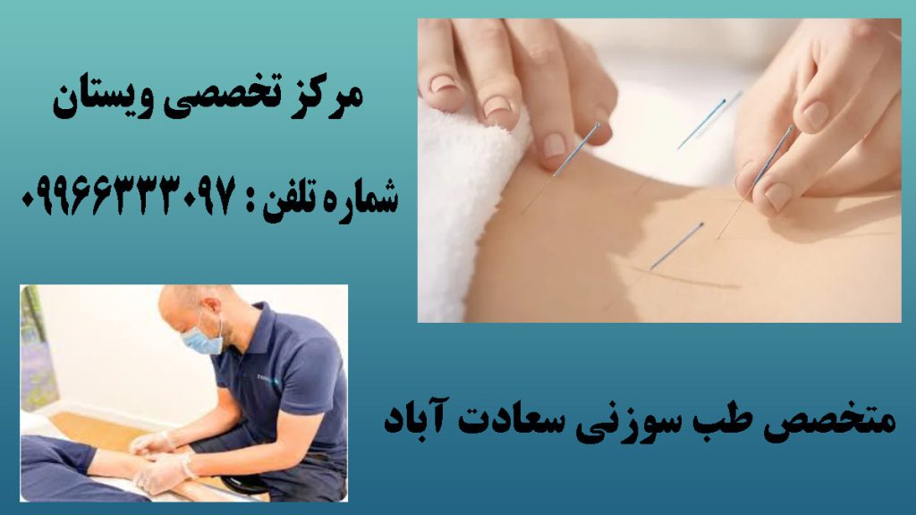دو تصویر از انجام طب سوزنی بر روی کمر و دست بیمار-نوشته :متخصص طب سوزنی سعادت آباد