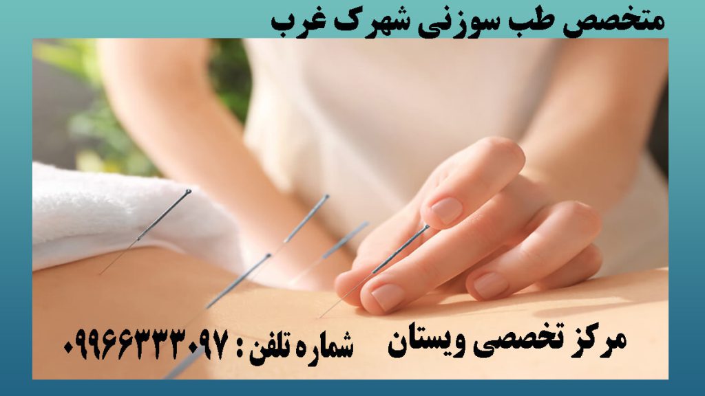 یک خانم در حال فرو کردن سوزن طب سوزنی بر کمر بیمار