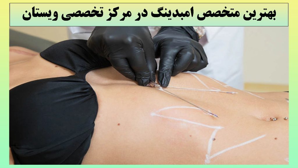 یک خانم در حال انجام امبدینگ شکم