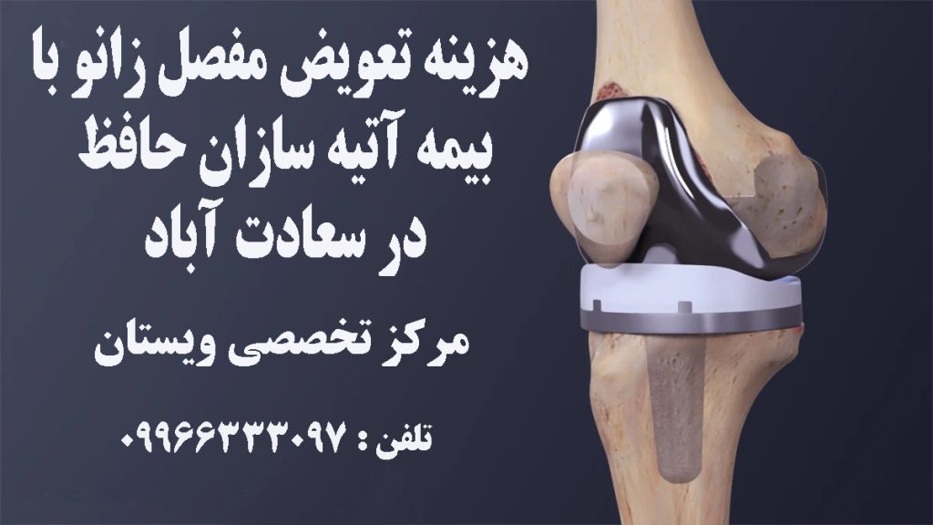 مفصل زانو بعد از جراحی تعویض مفصل-تصویر غیر واقعی