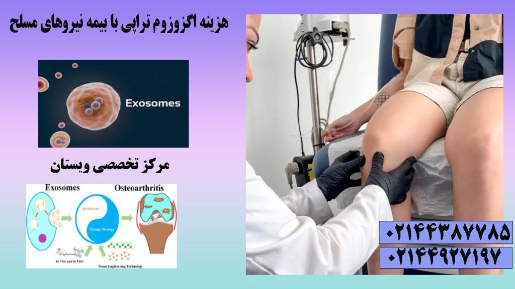 سه تصویر از اگزوزوم و تزریق آن به زانوی فرد بیمار