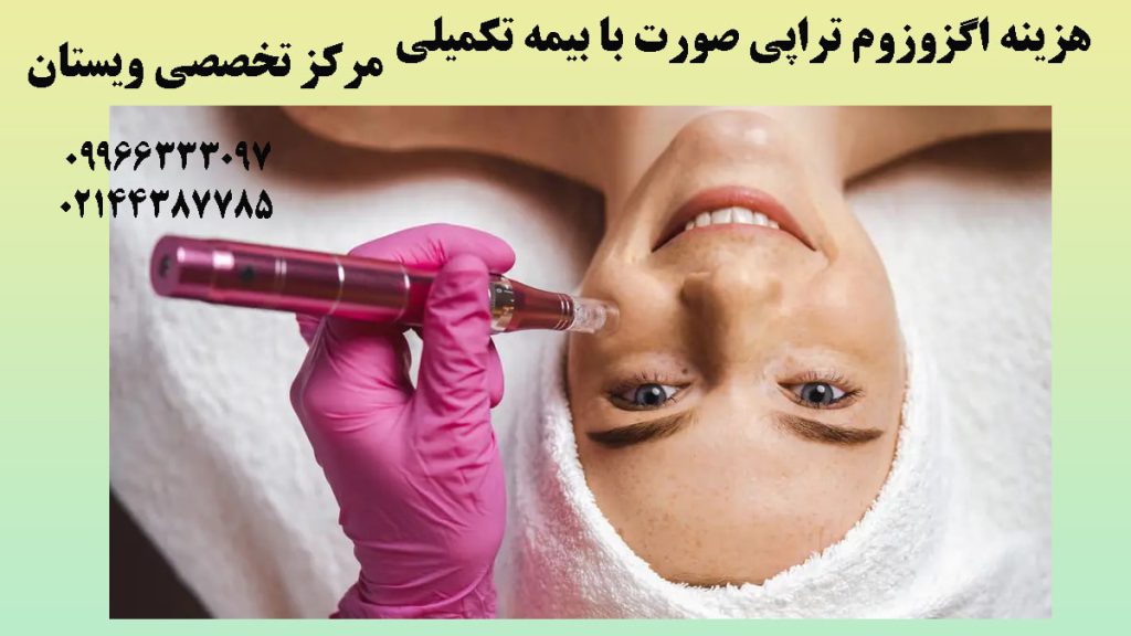 یک ظرف اگزوزوم با رنگ قرمز